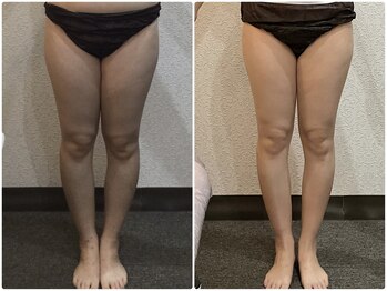 美容整体 ウェリナ 蟹江院/小顔矯正/骨盤矯正/美脚サロン 