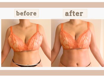 アンド ワイ(&y)/20代女性/出産歴なし