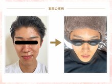 もちはだの雰囲気（★肌荒れ改善はもちろん自信を持てる肌を目指せます★）