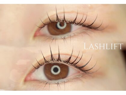 リプル(Lipul)の写真