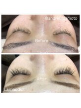 アンドアール(Beauty Place and-R)/4.施術☆自まつ毛ケアLashaddict