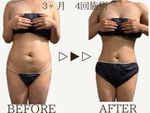 サロンドベル(salon de Belle)の雰囲気（【痩身】60分施術を4回。ラジオ波/キャビテーション/吸引/EMS）