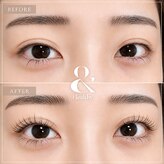 アイリス(EYELISS)