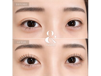 アイリス(EYELISS)の写真