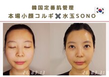 ルナビューティー 赤坂(LUNA beauty)