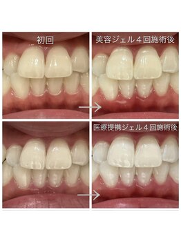 トゥジュール(Toujours)の写真/輝く明るい歯へ導くセルフホワイトニング!歯科衛生士がサポートする心地良い空間◎