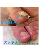 ネイルセラピーサロン プラムジュース(Nail Therapy Salon Plum Juice)/