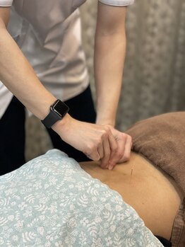 もりわき骨盤鍼灸整骨院 堺筋本町/◇鍼灸施術