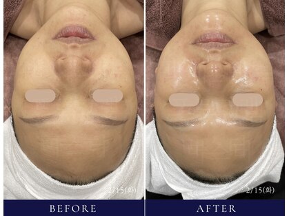 グランツ(Glanz)の写真