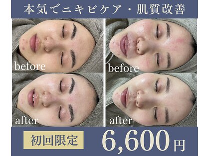 グリッター ショウナン(glitter.SHONAN)の写真