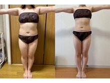 ヨサパーク オヨウ 荏原中延(YOSA PARK Oyou)/よもぎ蒸し/痩身/リンパ