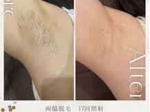 モアトゥインクル 福山神辺店(MORE twinkle)