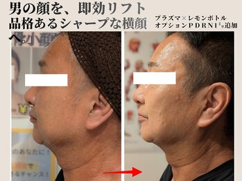 トリニティスペース(TrinitySpace)/レモンボトルビフォーアフター