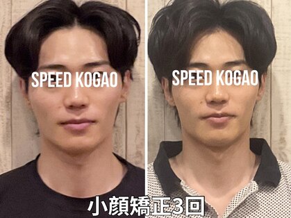 スピード小顔 渋谷店 (Speed)の写真