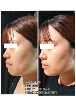 アオダモ(aodamo)/