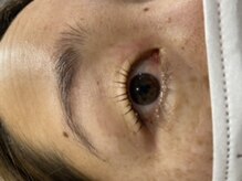 グラッシー(GLASSY)/Up force lift