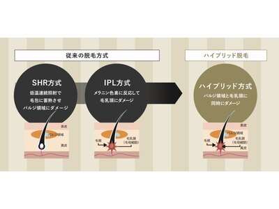 当店自慢の脱毛は抜けが違います！【SHR/うぶ毛・IPL/濃い毛】