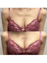 ジュエルリング(Jewel Ring)/バストアップ【恵比寿代官山】