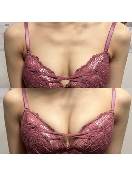 ジュエルリング(Jewel Ring)/バストアップ【恵比寿代官山】