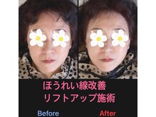 美容矯正サロン レレポノ(LELEPONO)/