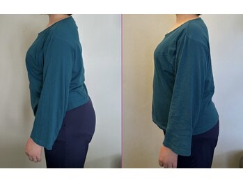 リセットモア(Reset More)/before after 1回の施術の変化