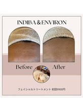 ドゥシュール(Douceur)/インディバ×エンビロン