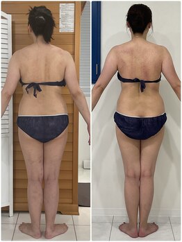 エゴ(EGO)/40代前半 164.0cm 7.3キロ減