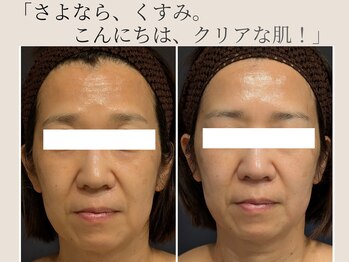 トリニティスペース(TrinitySpace)/レモンボトル×美白カクテル