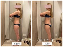 リノ(Lino)/顔＋全身リリースカッター