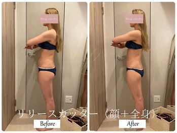 リノ(Lino)/顔+全身リリースカッター