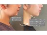 【リフトアップフルコース】フェイスライン引き上げ！50分 10,900→10,000