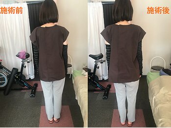 整体リラクゼーション パステル-I/お任せ80分コース/姿勢も綺麗に