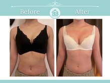 美人バスト 柏店/【バストアップ・育乳】症例