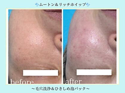 エクラニーク(Eclanique)の写真