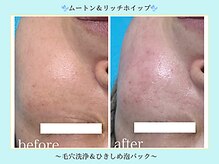 エクラニーク(Eclanique)