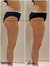 【女性限定】ヒップアップ◎美尻・美脚育成コース　60分