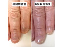 ユメネイル(YUME NAIL)の雰囲気（ジェルを使わない育成ケアで悩み爪卒業！3ヶ月で健康的な美爪に）