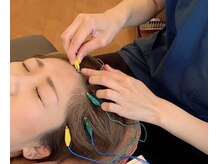 シシラ(shishira)/頭皮鍼で不眠改善！