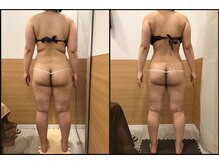 リッツ 浦和ボディ店(Ritz)/【Before/After】痩身