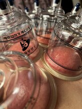 ビサイド(美side)/【カッピングケア】