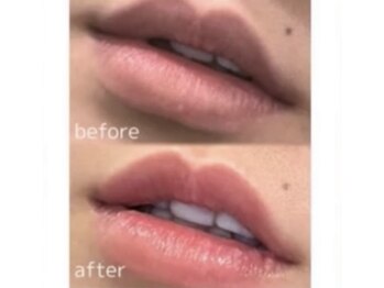 ミント(Mint)/【ローマピンク】唇リップ