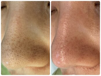 サイセイ(SAISEI)/