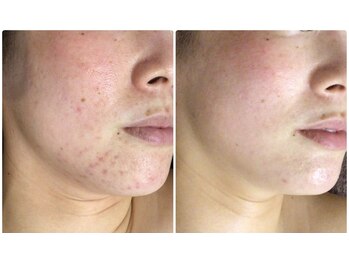 クレビア(CREBIA)/