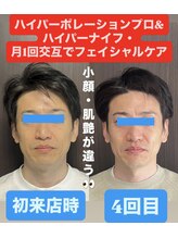 痩身ハイパーナイフメンズ【salon blue rose】新栄町/千種/痩身/ダイエット/脂肪燃焼/名古屋メンズエステ/新栄/千種