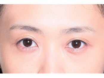 アイフラッシュ 心斎橋 大丸ホワイトアベニュー(Eye Flash)/☆before