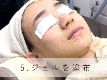 ラウレア 松山店(LAULEA)/お顔全体にジェルを塗布