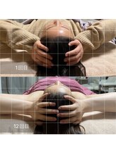 サン(SAN)/脳洗浄B/A