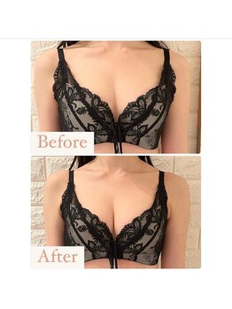 ハニー(Honey)/before★after