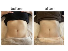 ユニ 下北沢駅前店(Uni)/美腸セラピー