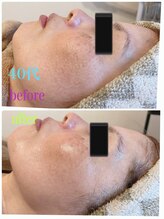 リヤン(Lien)/肌の透明感アップ♪